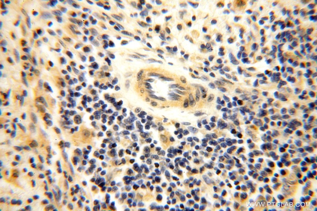 Immunohistochemistry (IHC) staining of human spleen tissue using GTDC1 Polyclonal antibody (16666-1-AP)