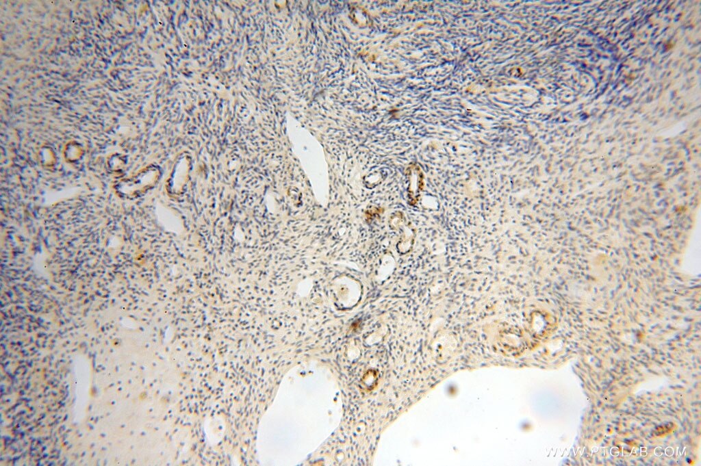 Immunohistochemistry (IHC) staining of human ovary tissue using GTDC1 Polyclonal antibody (16666-1-AP)