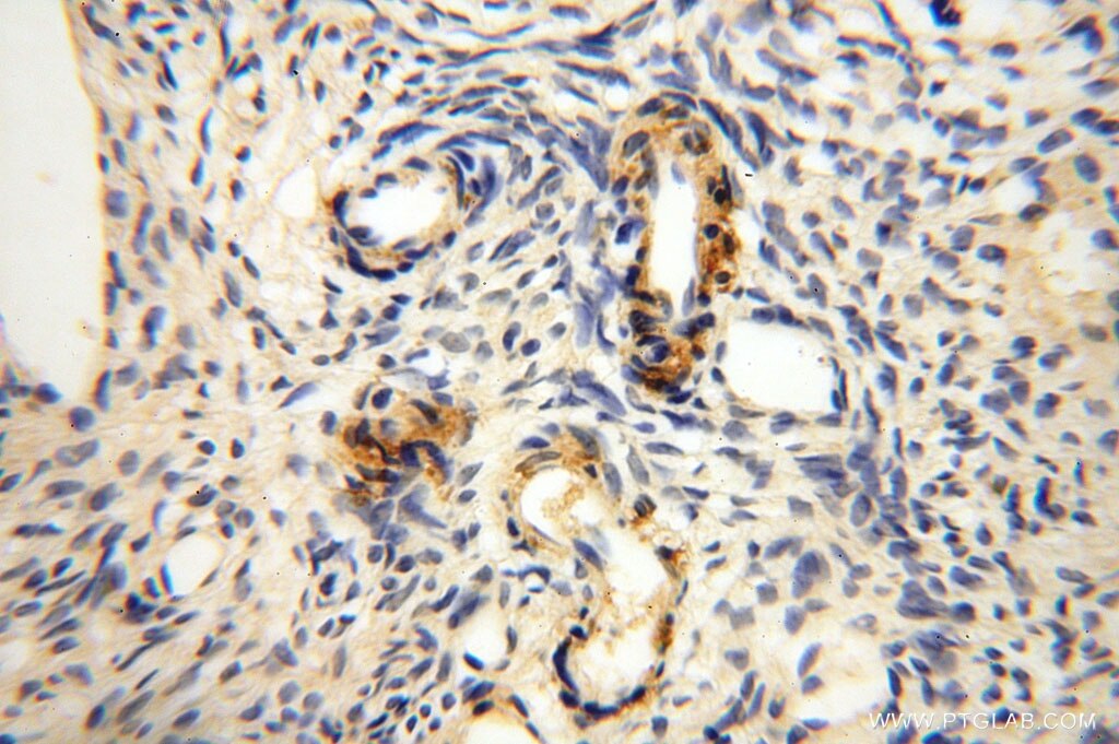 Immunohistochemistry (IHC) staining of human ovary tissue using GTDC1 Polyclonal antibody (16666-1-AP)