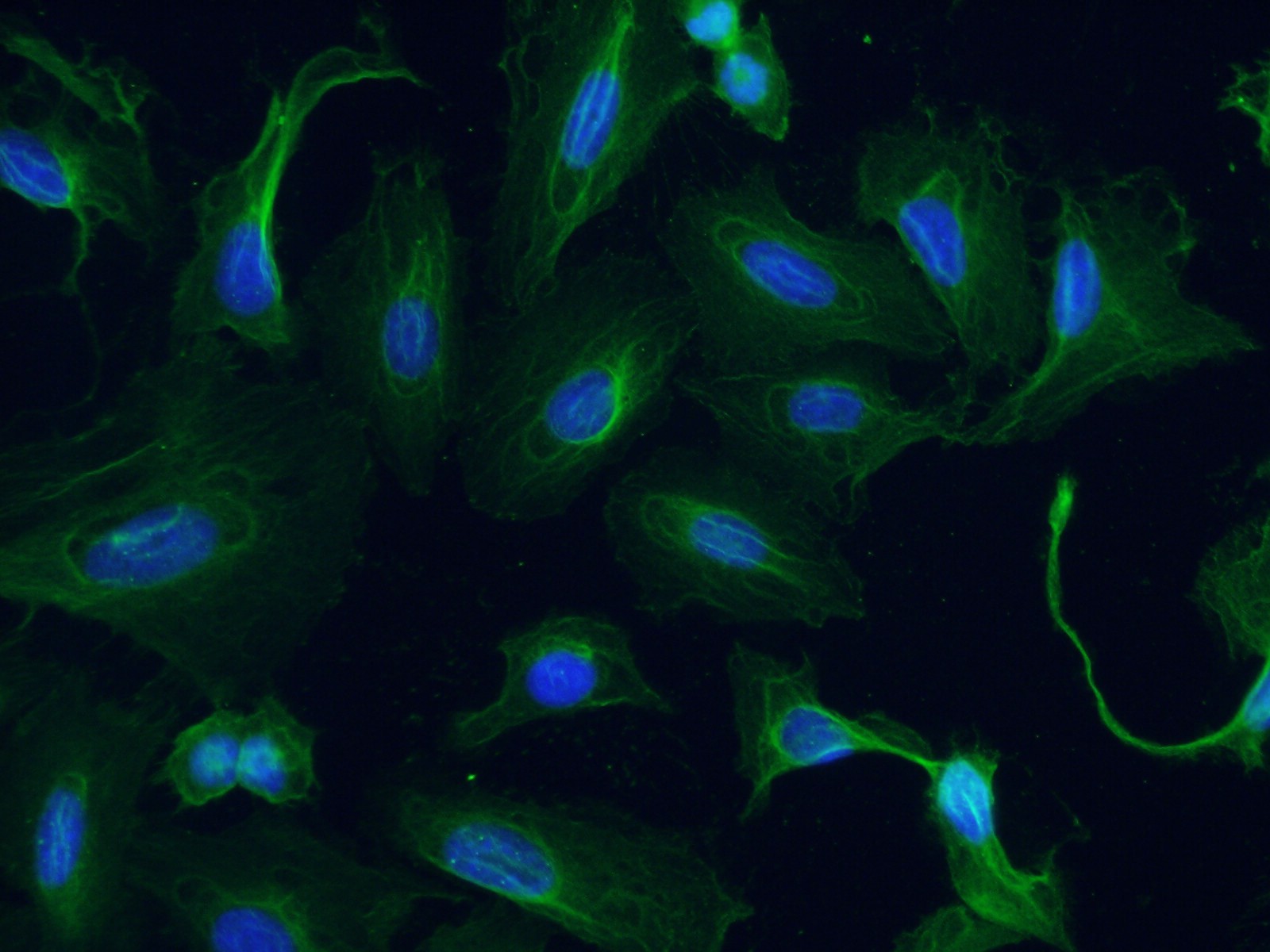 Immunofluorescence (IF) / fluorescent staining of U2OS cells using GTDC1 Monoclonal antibody (66578-1-Ig)