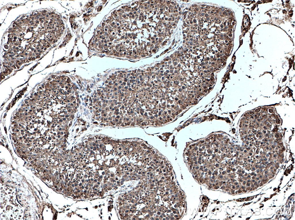 Immunohistochemistry (IHC) staining of human testis tissue using GTDC1 Monoclonal antibody (66578-1-Ig)