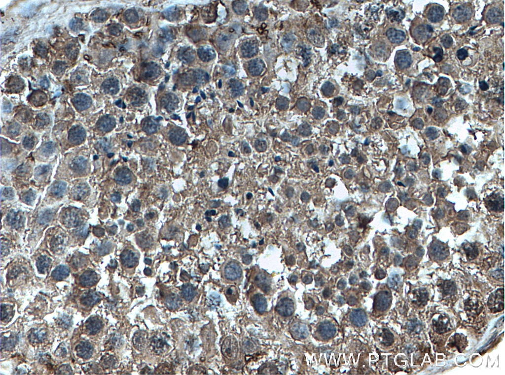 Immunohistochemistry (IHC) staining of human testis tissue using GTDC1 Monoclonal antibody (66578-1-Ig)