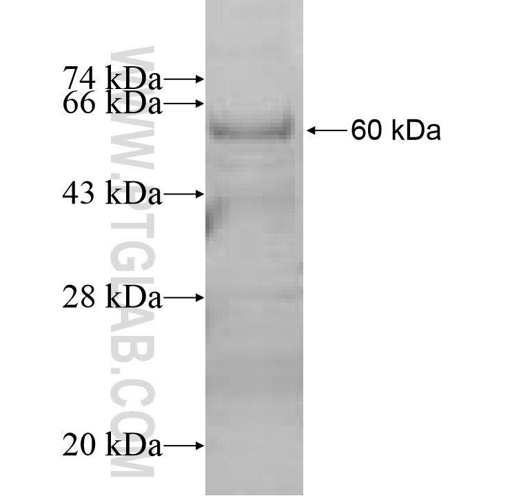 GTDC1 fusion protein Ag10145 SDS-PAGE