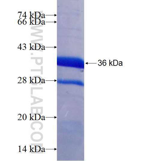 GTDC1 fusion protein Ag9934 SDS-PAGE
