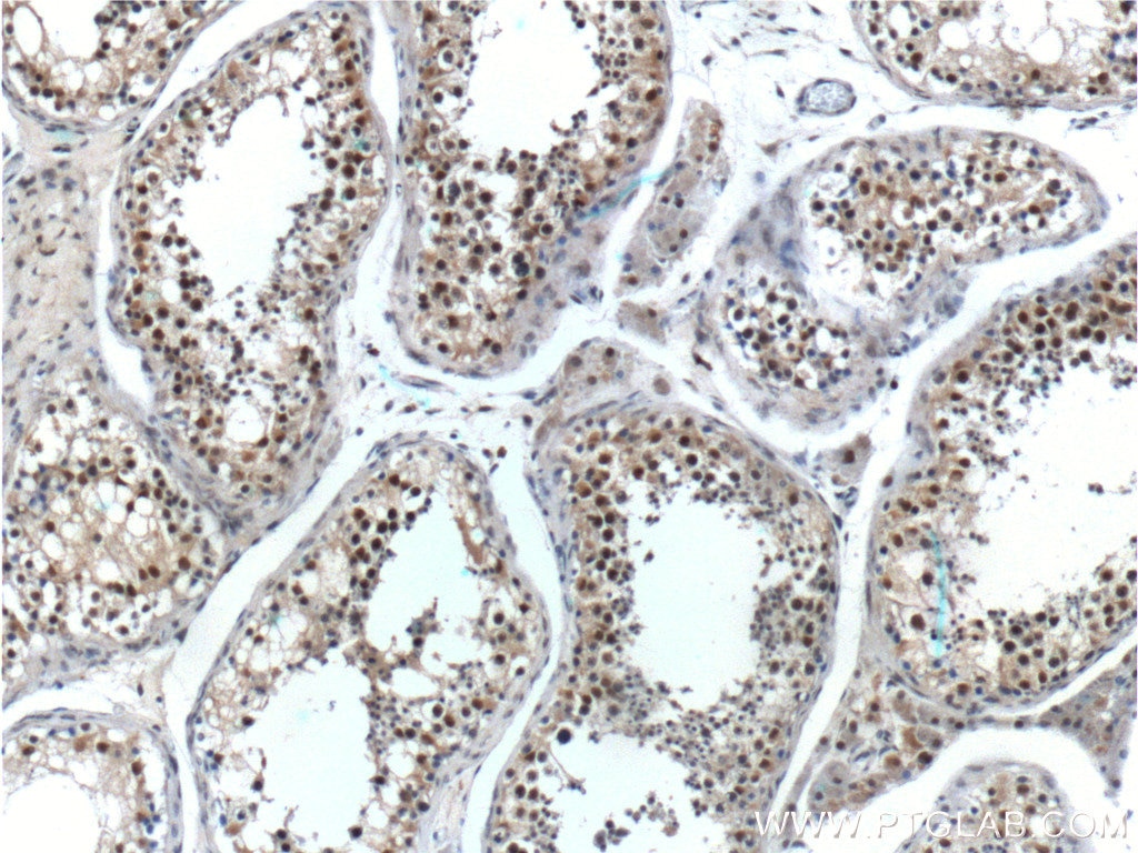Immunohistochemistry (IHC) staining of human testis tissue using GTF2A1 Polyclonal antibody (21381-1-AP)