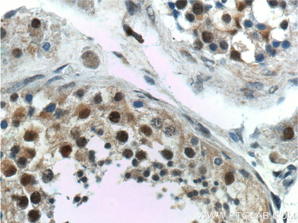 Immunohistochemistry (IHC) staining of human testis tissue using GTF2A1 Polyclonal antibody (21381-1-AP)