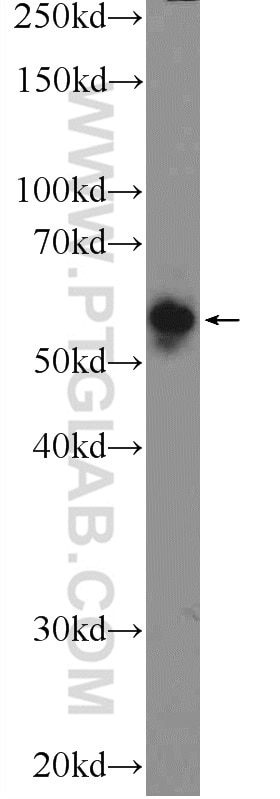 Western Blot (WB) analysis of BGC-823 cells using GTF2A1 Polyclonal antibody (21381-1-AP)