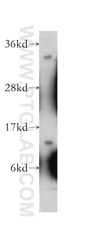 Western Blot (WB) analysis of HeLa cells using GTF2A2 Polyclonal antibody (10540-1-AP)