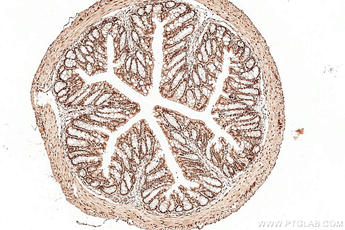 Immunohistochemistry (IHC) staining of mouse colon tissue using GTF2B Polyclonal antibody (16467-1-AP)