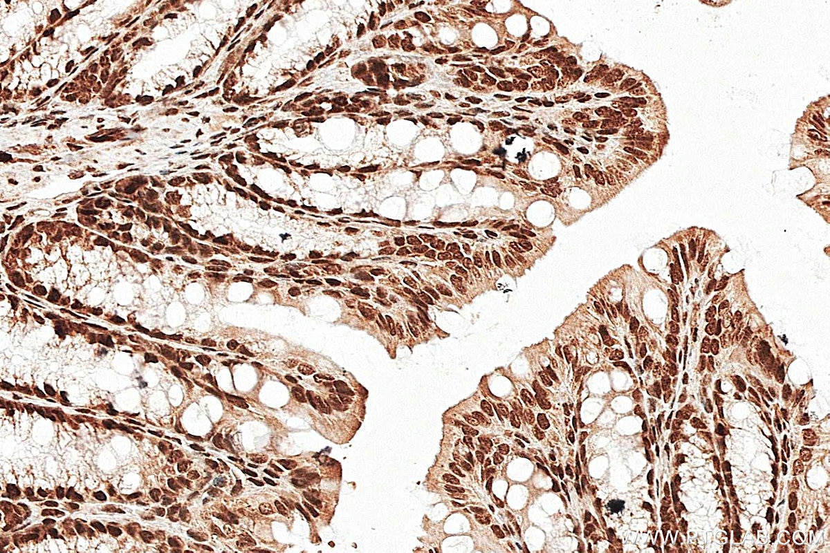 Immunohistochemistry (IHC) staining of mouse colon tissue using GTF2B Polyclonal antibody (16467-1-AP)
