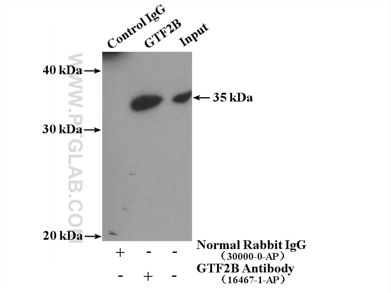 Immunoprecipitation (IP) experiment of K-562 cells using GTF2B Polyclonal antibody (16467-1-AP)