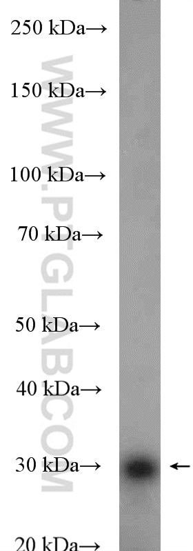 WB analysis of HeLa using 16467-1-AP