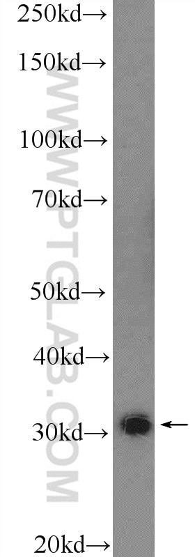 GTF2B Polyclonal antibody