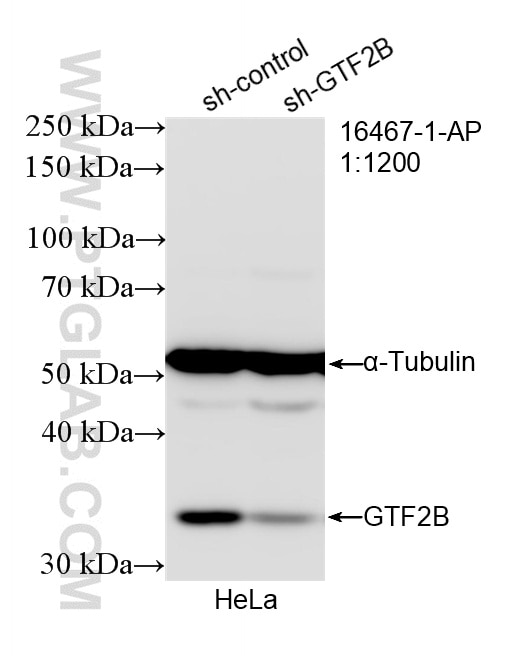 WB analysis of HeLa using 16467-1-AP Western Blot (WB) analysis of HeLa cells using GTF2B Polyclonal antibody (16467-1-AP)