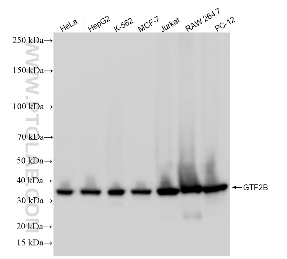 WB analysis using 87643-2-RR (same clone as 87643-2-PBS) Western Blot (WB) analysis of various lysates using GTF2B Recombinant monoclonal antibody (87643-2-RR)