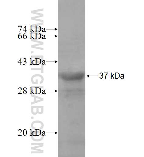 GTF2B fusion protein Ag9663 SDS-PAGE