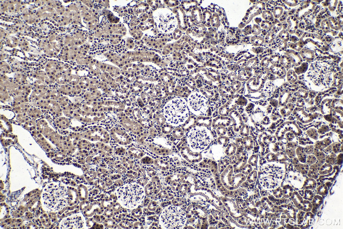Immunohistochemistry (IHC) staining of rat kidney tissue using GTF2E1 Polyclonal antibody (24405-1-AP)