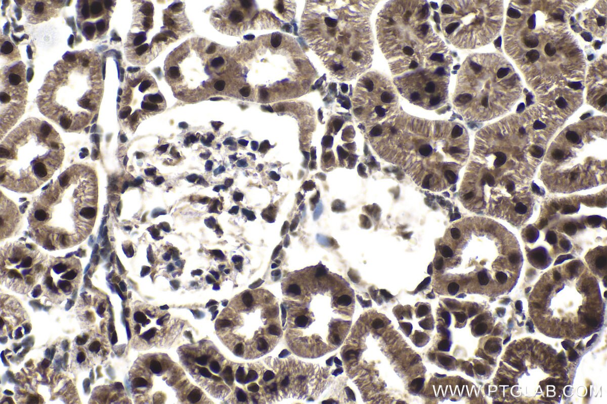 Immunohistochemistry (IHC) staining of rat kidney tissue using GTF2E1 Polyclonal antibody (24405-1-AP)