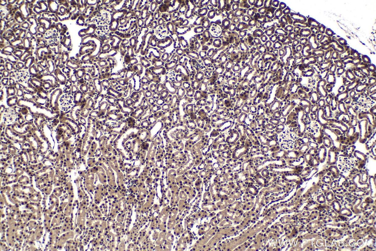 Immunohistochemistry (IHC) staining of mouse kidney tissue using GTF2E1 Polyclonal antibody (24405-1-AP)