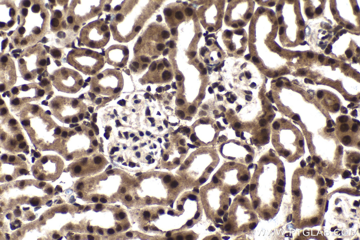 Immunohistochemistry (IHC) staining of mouse kidney tissue using GTF2E1 Polyclonal antibody (24405-1-AP)
