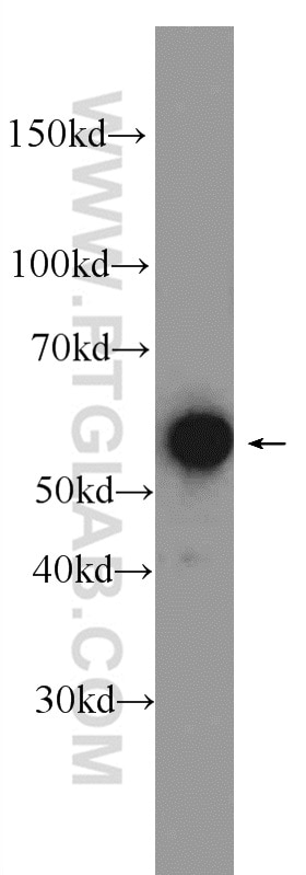 Western Blot (WB) analysis of HEK-293 cells using GTF2E1 Polyclonal antibody (24405-1-AP)