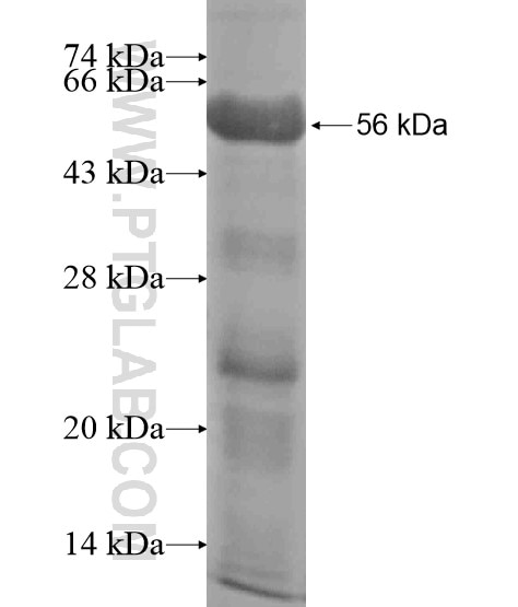 GTF2E1 fusion protein Ag19794 SDS-PAGE