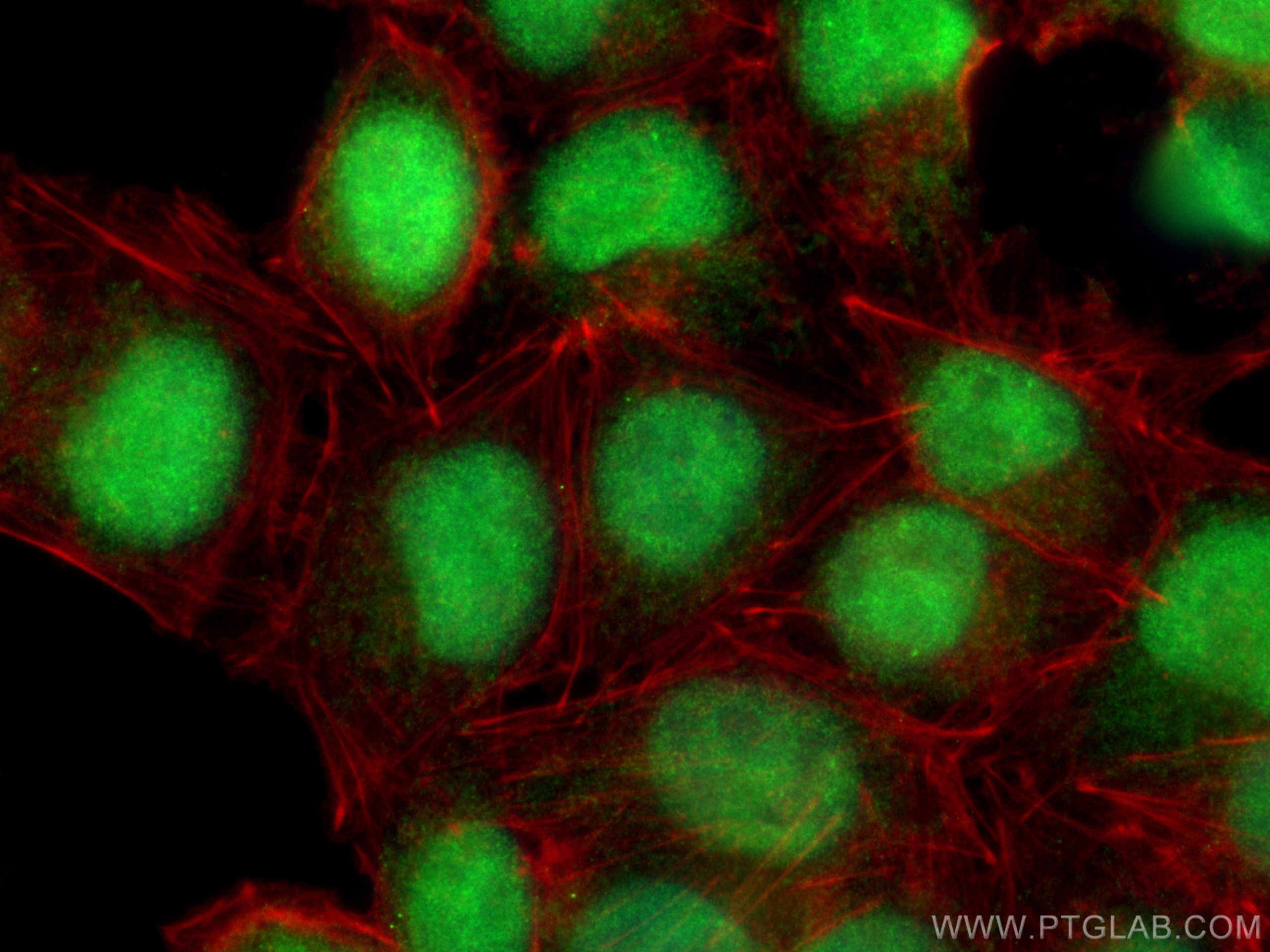 Immunofluorescence (IF) / fluorescent staining of A375 cells using TFIIE Beta Polyclonal antibody (11596-1-AP)