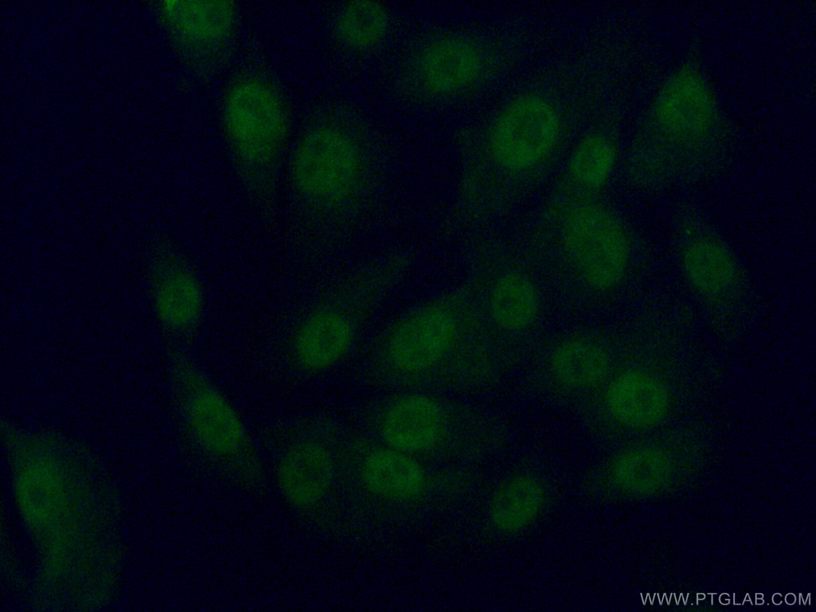 Immunofluorescence (IF) / fluorescent staining of A375 cells using TFIIE Beta Polyclonal antibody (11596-1-AP)