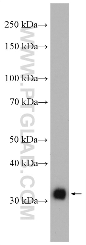 Western Blot (WB) analysis of Jurkat cells using TFIIE Beta Polyclonal antibody (11596-1-AP)