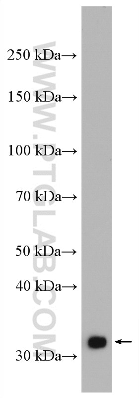 Western Blot (WB) analysis of K-562 cells using TFIIE Beta Polyclonal antibody (11596-1-AP)