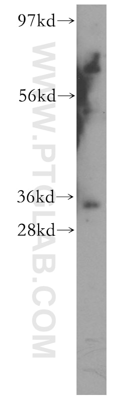 Western Blot (WB) analysis of A375 cells using TFIIE Beta Polyclonal antibody (11596-1-AP)