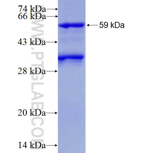 TFIIE beta fusion protein Ag2136 SDS-PAGE
