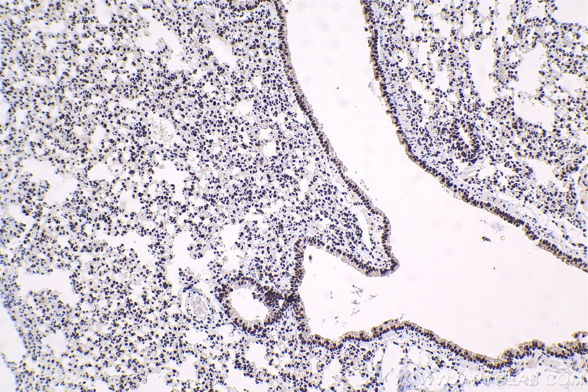Immunohistochemistry (IHC) staining of mouse lung tissue using GTF2F1 Polyclonal antibody (10093-2-AP)