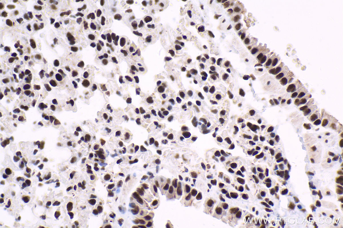 Immunohistochemistry (IHC) staining of mouse lung tissue using GTF2F1 Polyclonal antibody (10093-2-AP)