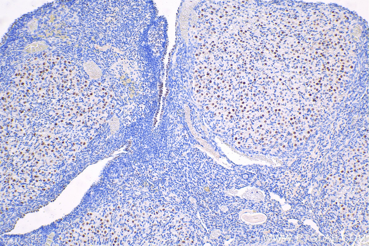 IHC staining of rat ovary using 10093-2-AP