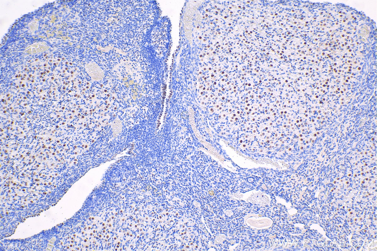 Immunohistochemistry (IHC) staining of rat ovary tissue using GTF2F1 Polyclonal antibody (10093-2-AP)