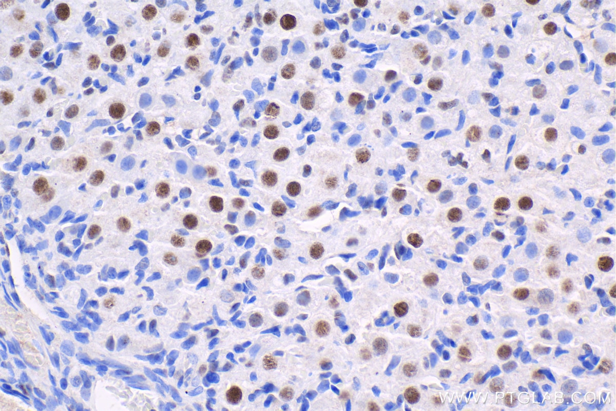 Immunohistochemistry (IHC) staining of rat ovary tissue using GTF2F1 Polyclonal antibody (10093-2-AP)