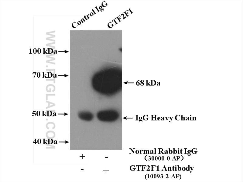 Immunoprecipitation (IP) experiment of K-562 cells using GTF2F1 Polyclonal antibody (10093-2-AP)