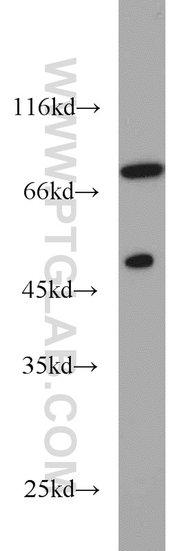 GTF2F1 Polyclonal antibody