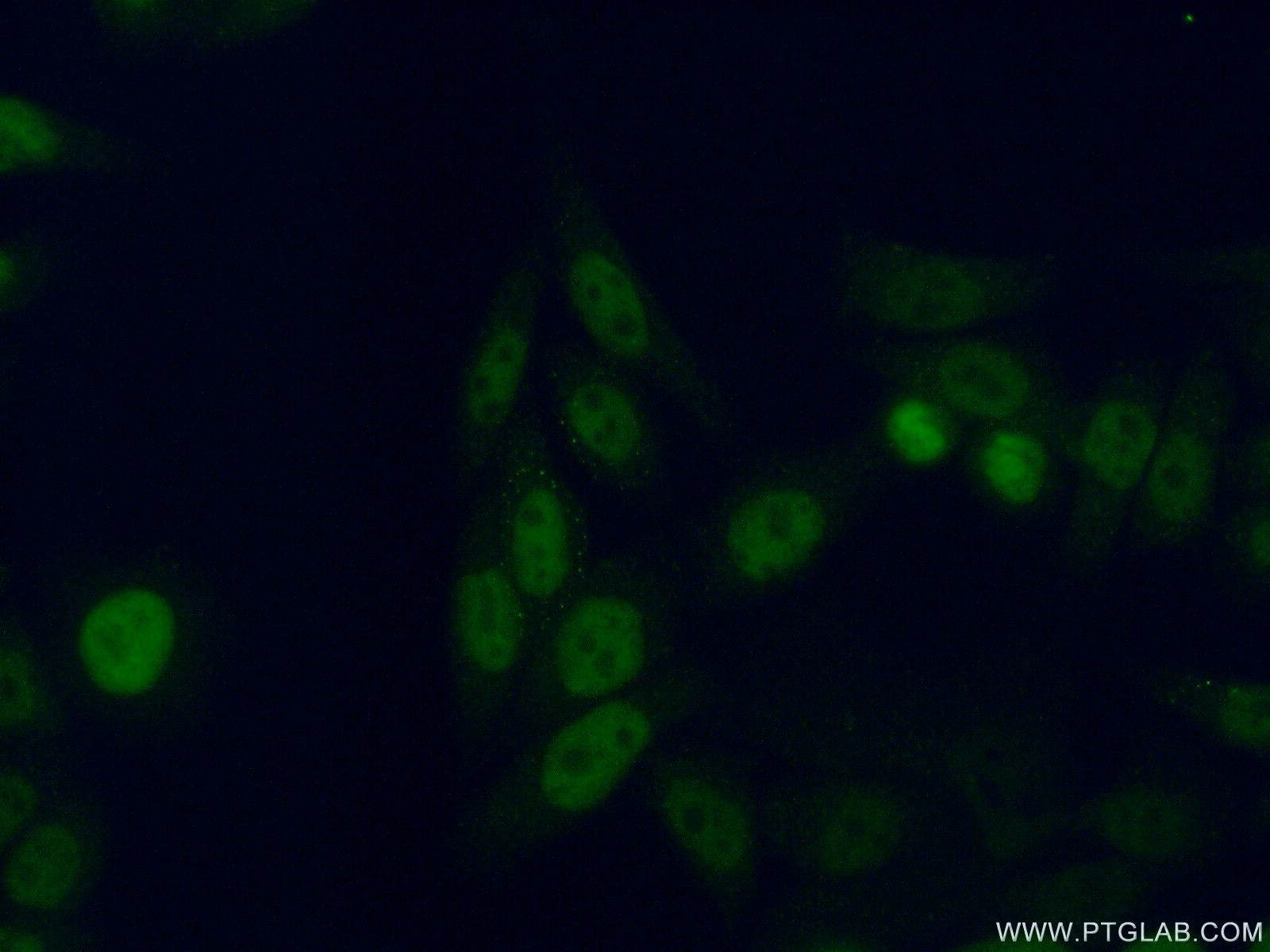 Immunofluorescence (IF) / fluorescent staining of HeLa cells using GTF2F2 Polyclonal antibody (15139-1-AP)