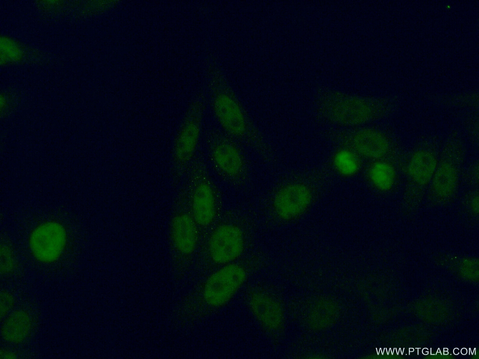 IF Staining of HeLa using 15139-1-AP