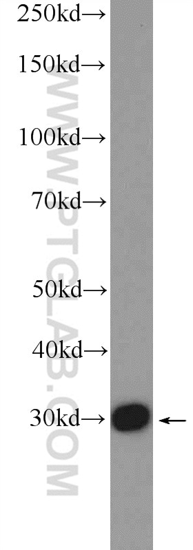 Western Blot (WB) analysis of mouse spleen tissue using GTF2F2 Polyclonal antibody (15139-1-AP)