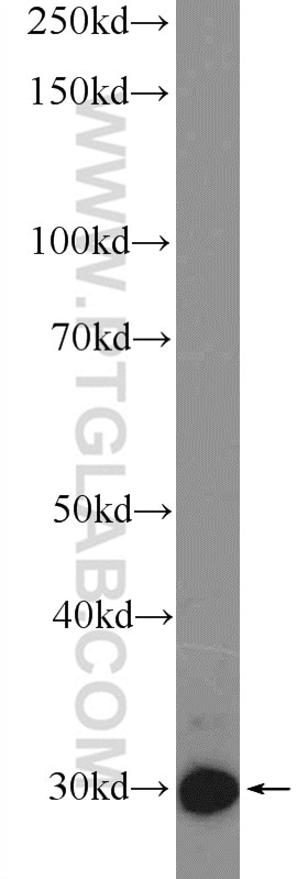 Western Blot (WB) analysis of rat spleen tissue using GTF2F2 Polyclonal antibody (15139-1-AP)