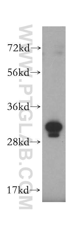Western Blot (WB) analysis of HeLa cells using GTF2F2 Polyclonal antibody (15139-1-AP)