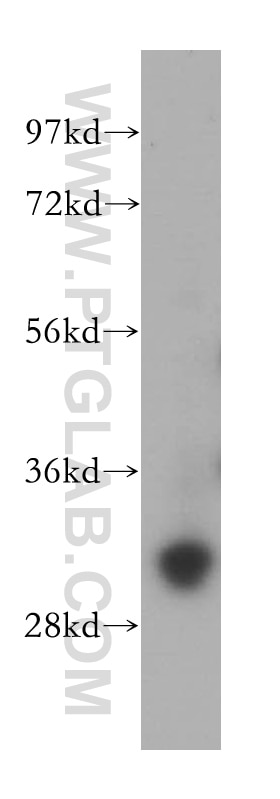 Western Blot (WB) analysis of PC-3 cells using GTF2F2 Polyclonal antibody (15139-1-AP)