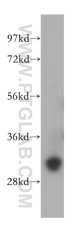 WB analysis of PC-3 using 15139-1-AP