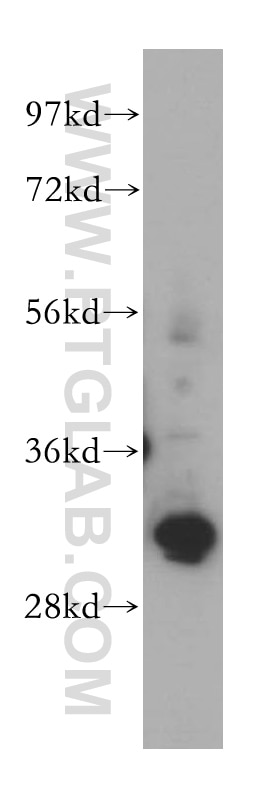 Western Blot (WB) analysis of K-562 cells using GTF2F2 Polyclonal antibody (15139-1-AP)