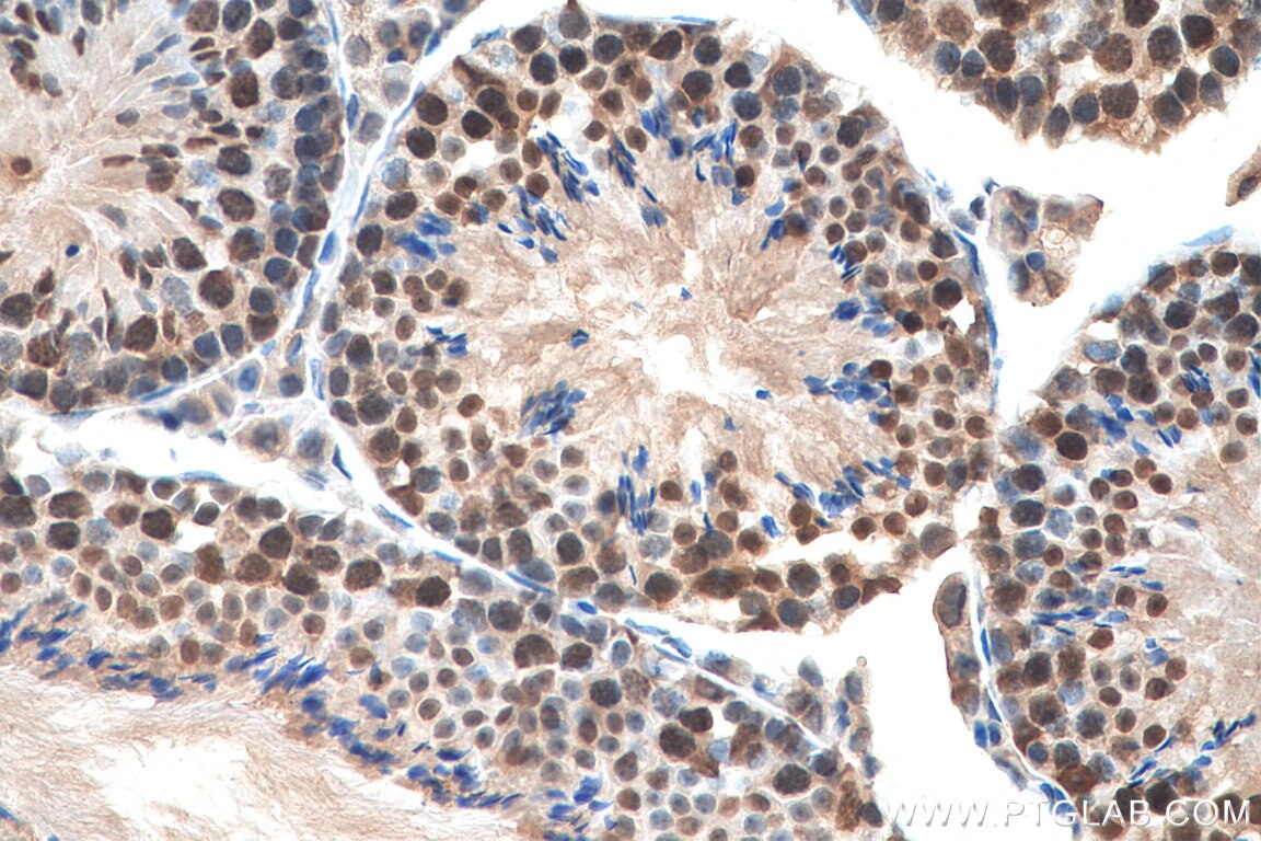 Immunohistochemistry (IHC) staining of mouse testis tissue using GTF2H1 Polyclonal antibody (10173-1-AP)