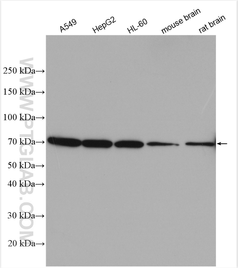 Western Blot (WB) analysis of various lysates using GTF2H1 Polyclonal antibody (10173-1-AP)