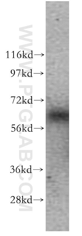 Western Blot (WB) analysis of mouse brain tissue using GTF2H1 Polyclonal antibody (10173-1-AP)